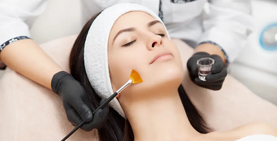 peeling chemiczny